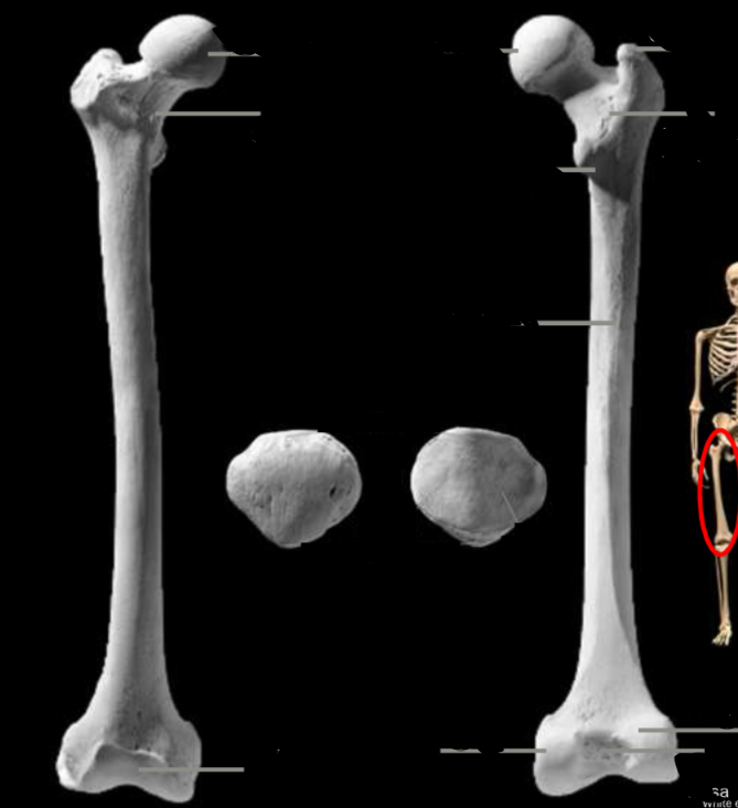 <p>Identify the linea aspera</p>