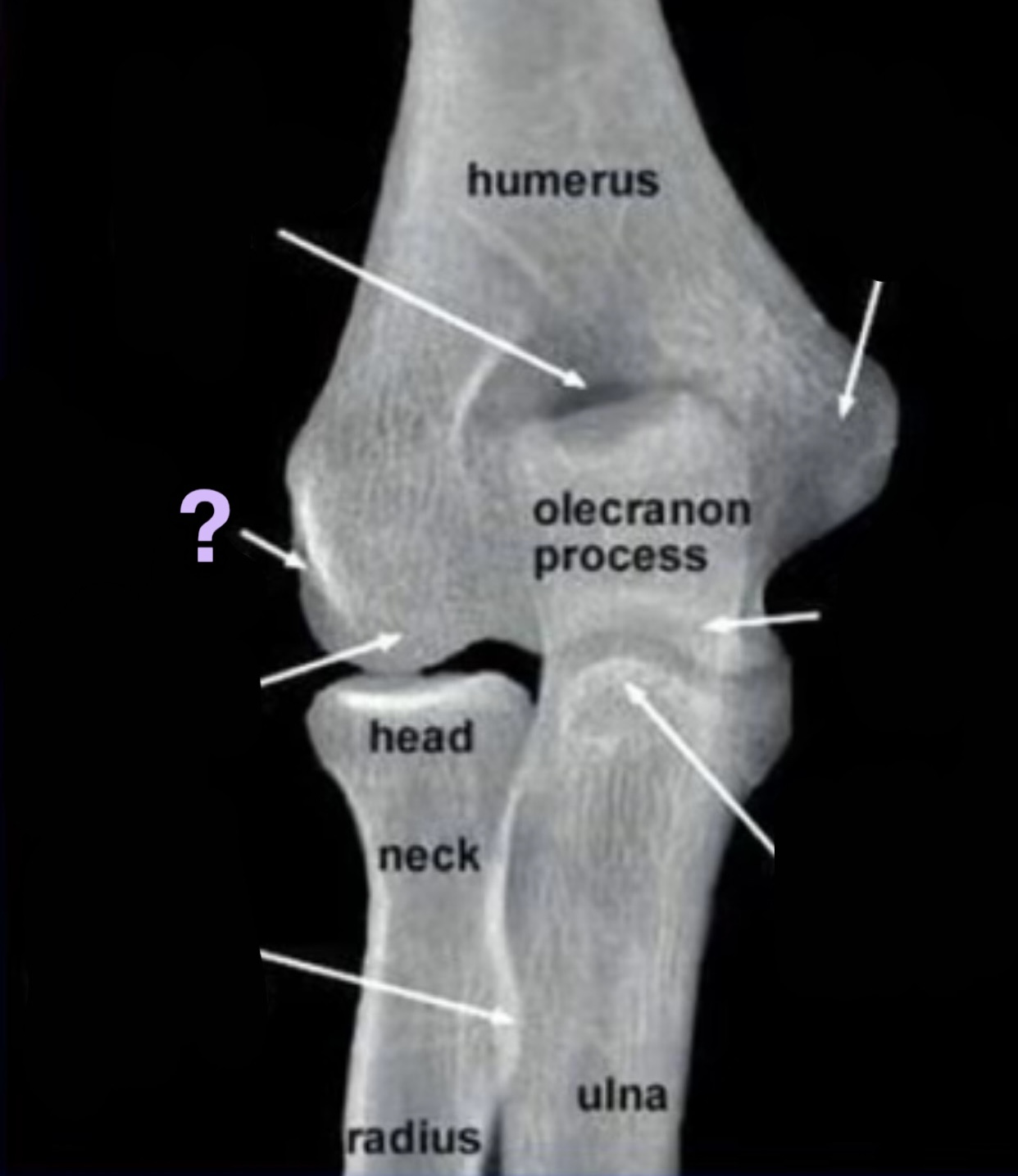 term image