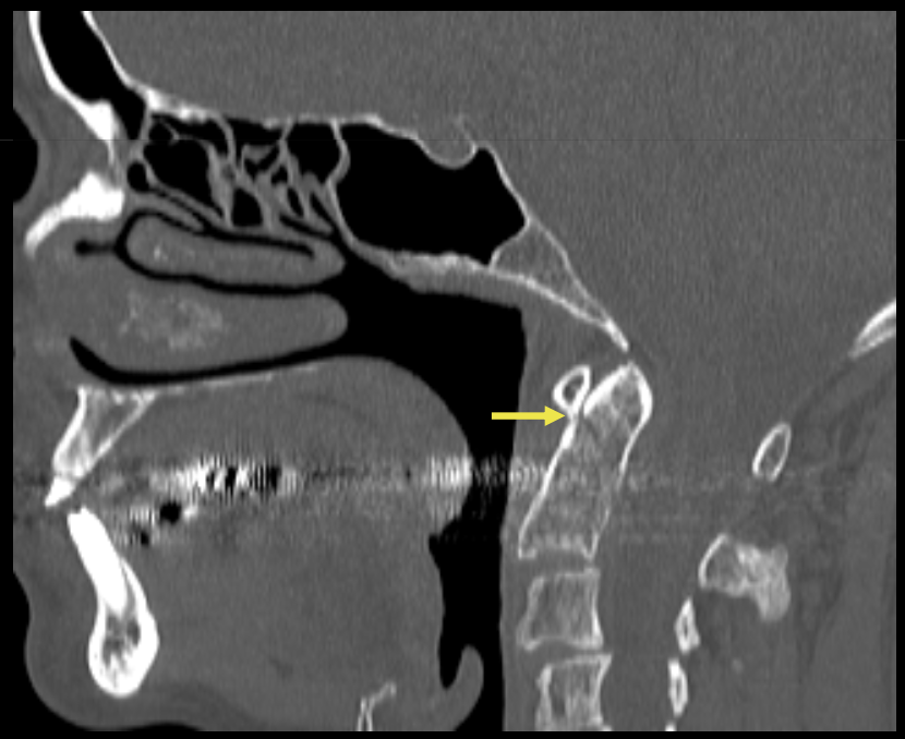 <p><span style="color: blue;"><strong>Que regarde-t-on ?</strong></span></p>
