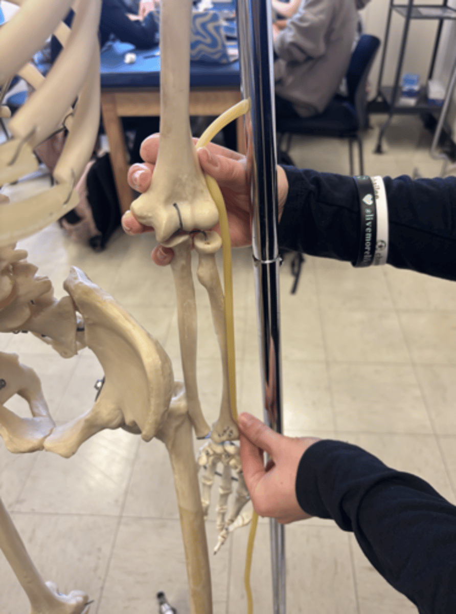 <p>What is this muscle?</p>