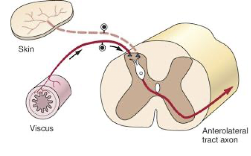 <ul><li><p>Origin of symptoms referred to other areas of the body </p></li><li><p>Convergence of visceral and somatic afferent nerve fibers </p></li></ul><p></p>