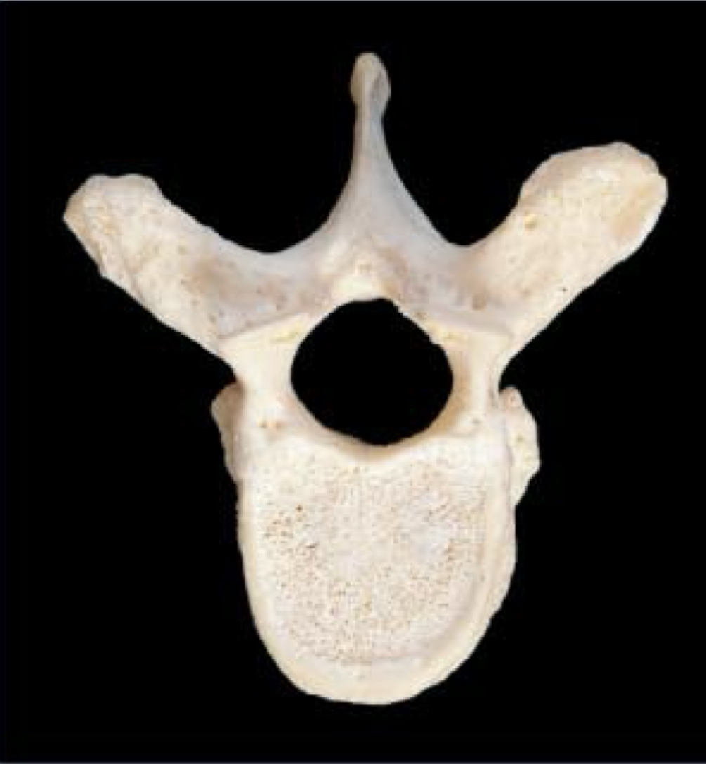 <p>What Vertebrae is this?</p>