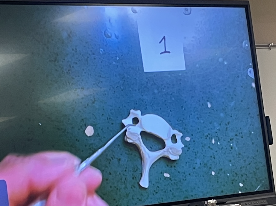 anatomy vertebral column and ribs practical Flashcards Knowt