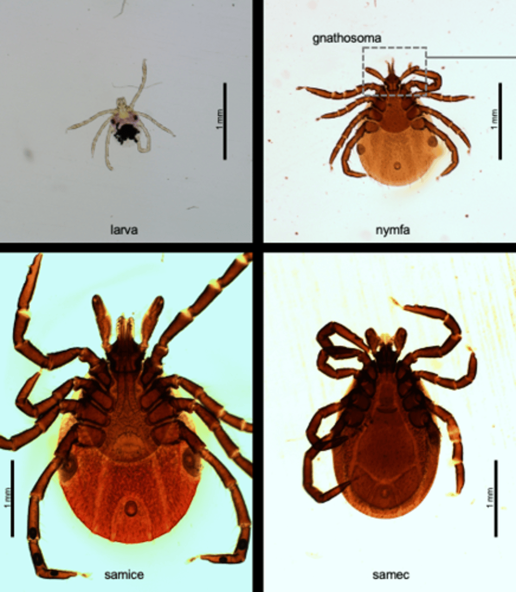 <p>(tick) (Parasitiformes) Stigmata visible behind the fourth pair of legs, positioned within the stigmatic plate; No prodorsum, but ticks have a dorsal shield (scutum)</p>