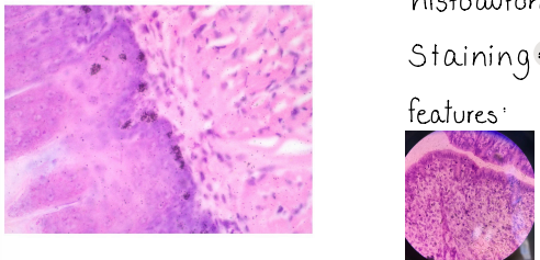 <p>DNA synthesis</p><p>histoavtoradiography</p><p>staining : hematoxylin - eosin</p>