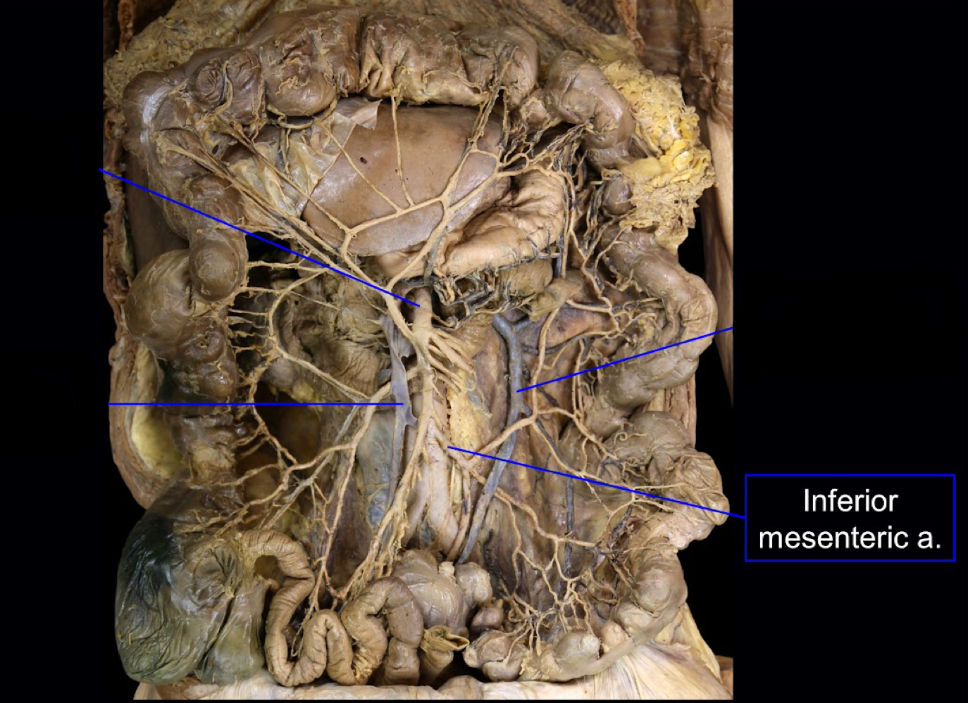 <p>hindgut<br>(highlighted: inferior mesenteric artery)</p>