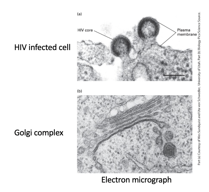 <p>virus core - enveloped by region of cell plasma membrane that contains specific viral proteins </p><p>HIV particles - bud from plasma membrane </p>