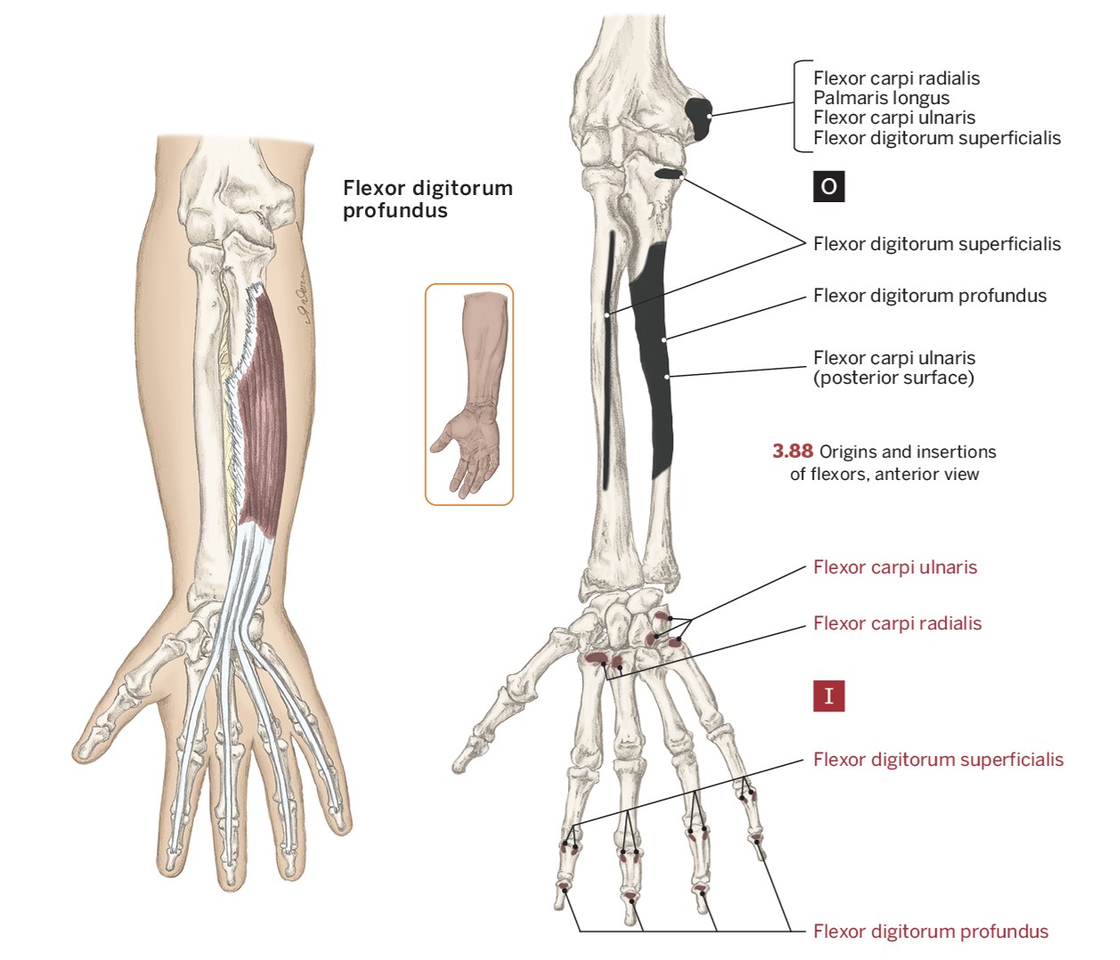 <p>O- Anterior Ulna</p><p>I- (Anterior) 2nd to 5th distal phalanges</p><p>A- Flexion of 2nd to 5th metacarpophalangeal &amp; proximal interphalangeal joints</p>