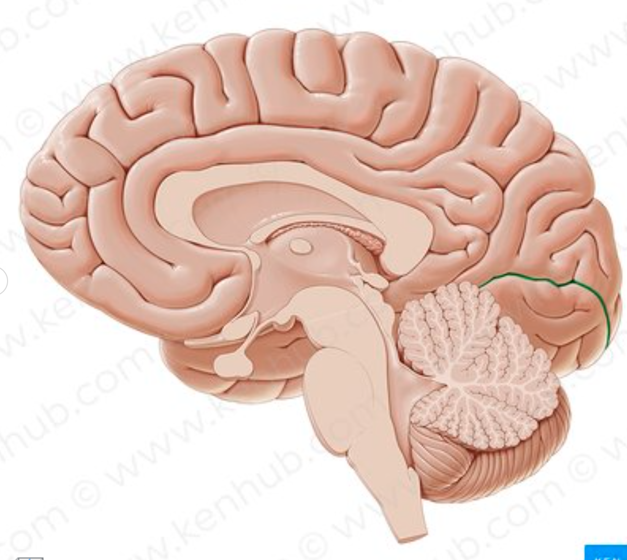 <p>which sulcus is in green?</p>