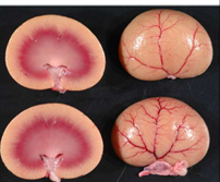 <p>Enlarged waxy pale dark brown </p><p>Liver,spleen,kidney</p>