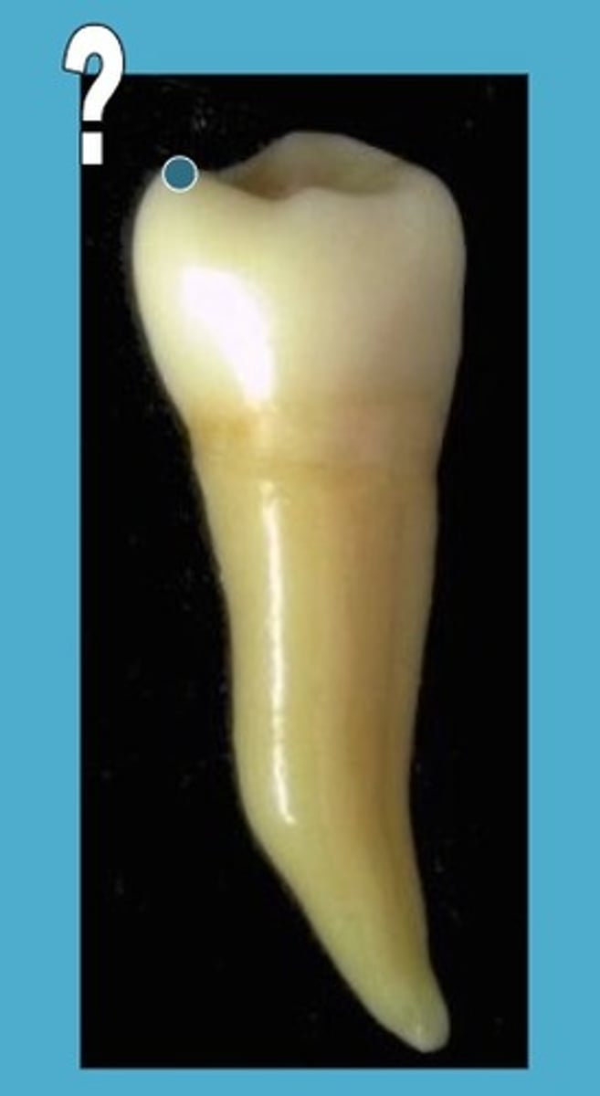 <p>usually tapers slightly to the lingual</p>