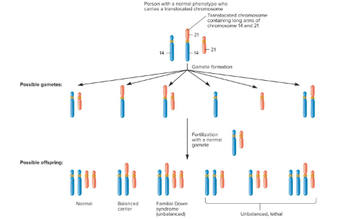 <p>Translocations that are not reciprocal that alter the total amount of genetic material. They often duplicate or delete material. Unlike reciprocal translocations, these are associated with phenotypic abnormalities.</p><p>Ex) Familial down syndrome → majority of chromosome 21 is attached to chromosome 14, so offspring may have three copies of genes found on a large segment of chromosome 21.</p>