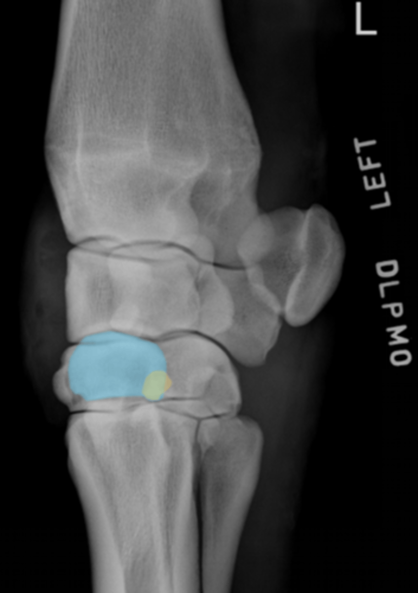 <p>What bone is highlighted in yellow? Blue?</p>