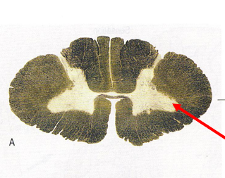 <p>Which spinal cord segment?</p>