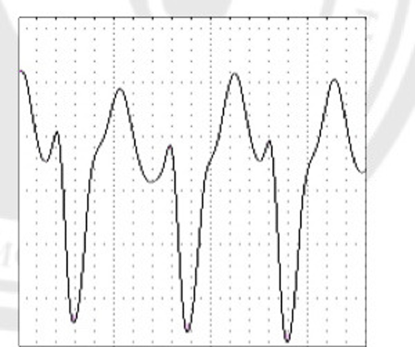 <p>What is the origin of this ECG?</p>