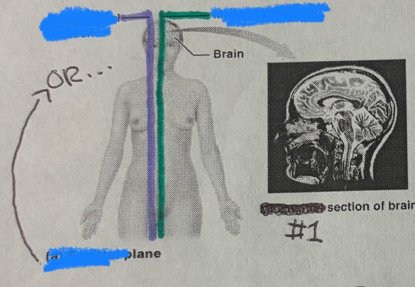 <p>What section/plane is the purple line?</p>