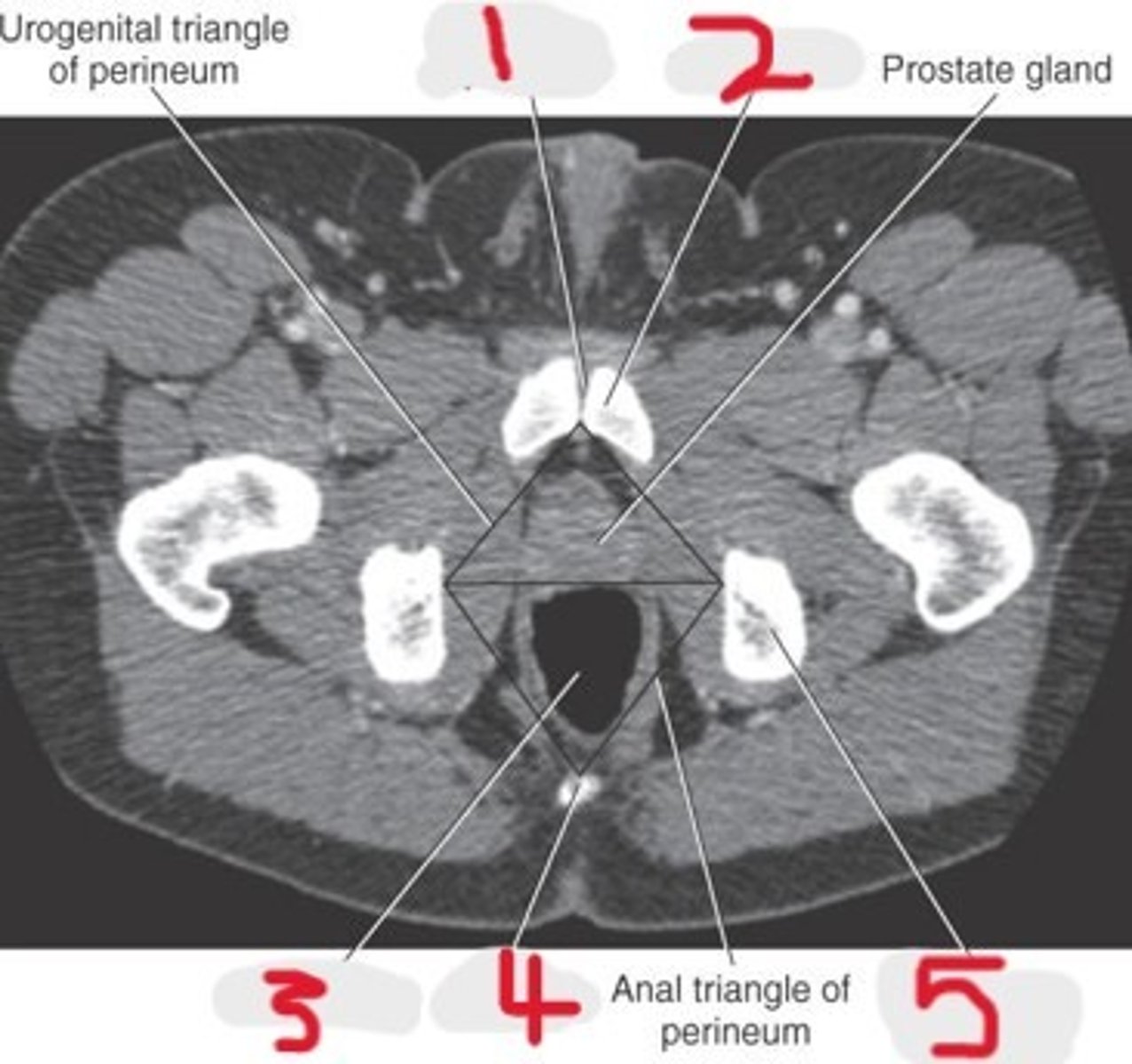 <p>Name all numbered structures</p>