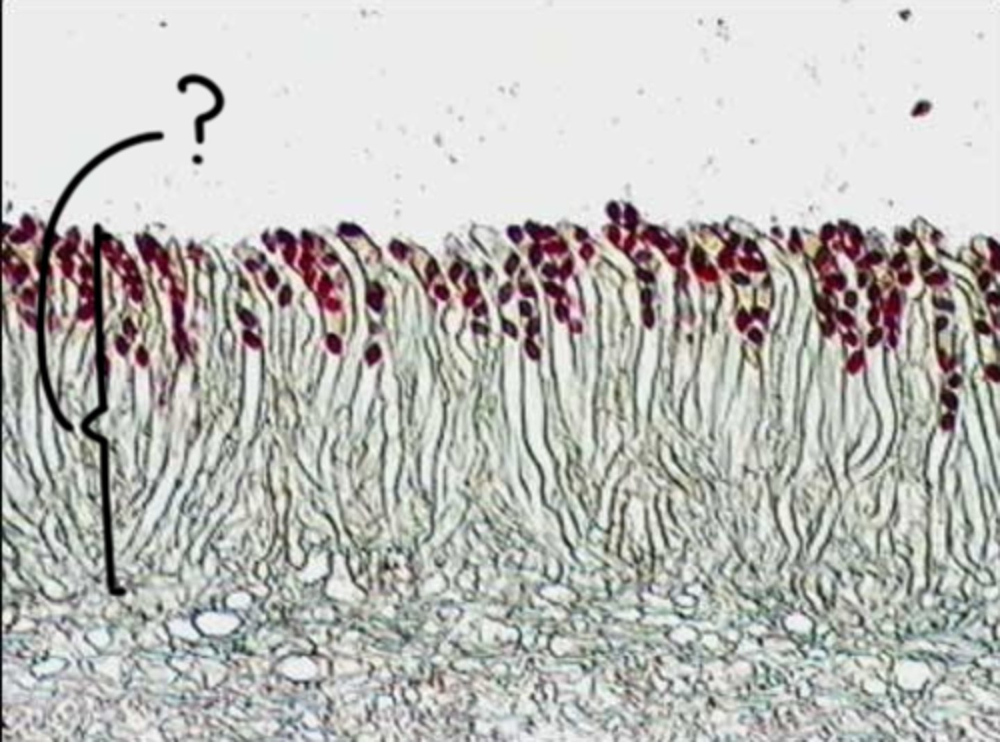 <p>The fruiting body of an ascomycete fungus, often containing the hymenial layer and developing from the mycelium, serving as a reproductive structure.</p>