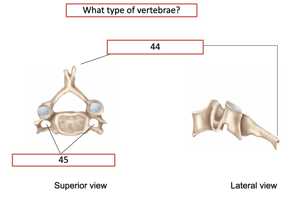 <p>What type of vertebrae?</p>