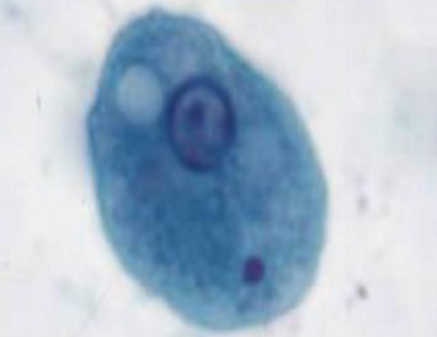 <p>entamoeba coli trophozoite </p>