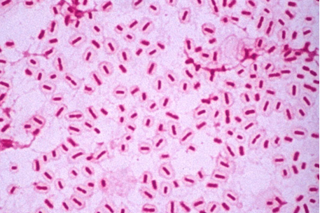 Haemophilus influenzae