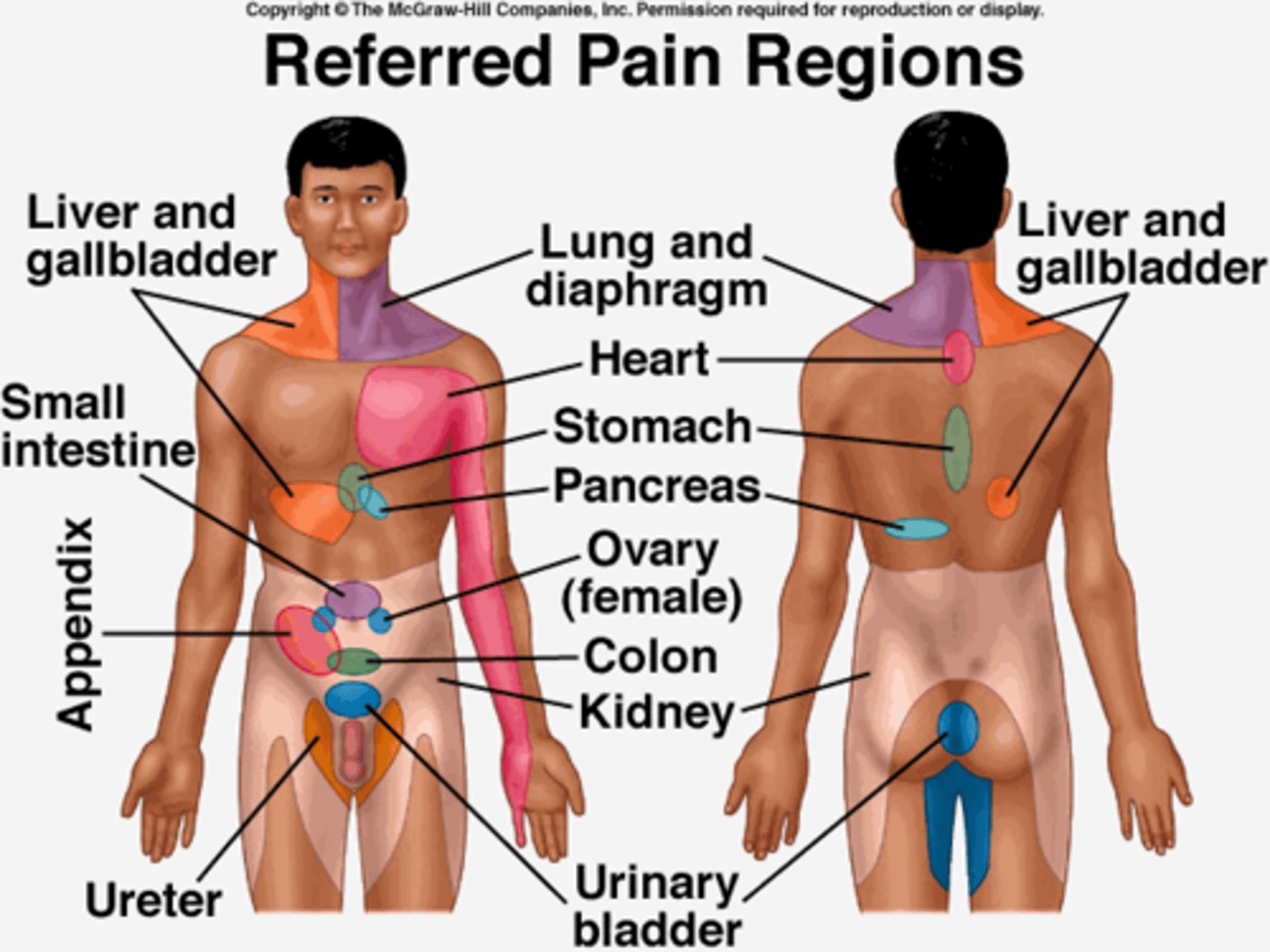 <p>pain felt in a part of the body other than its actual source</p>