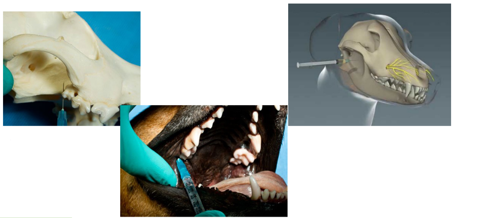 <p>which nerve block is this</p>