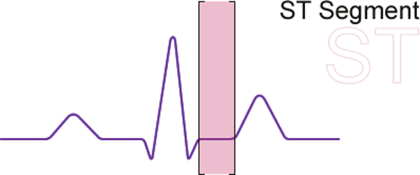 <p>time between ventricular depolarization and repolarization</p>