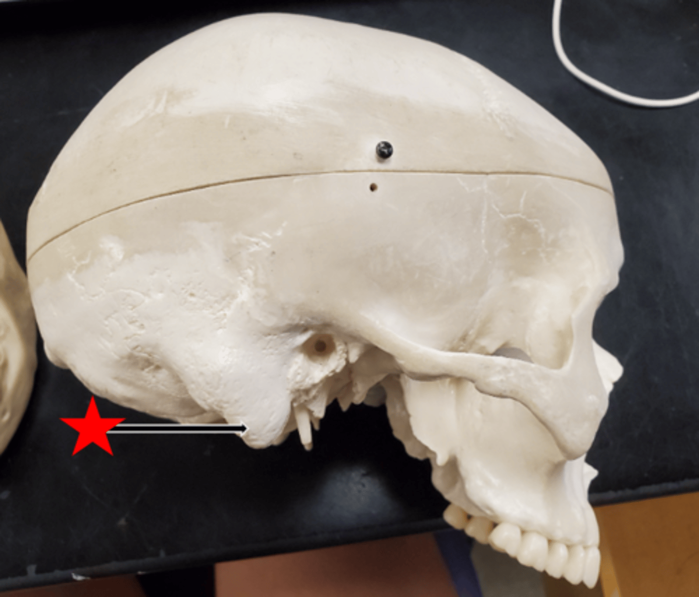 <p>Name the starred region in the image.</p>