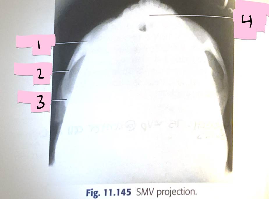 <p>What is 2 pointing to?</p>