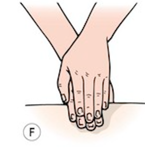 <p>Utförs med fingerblomman på ett eller flera fingrar samtidigt, med ett ökande tryck som når djupare i mjukdelarna. Friktionerna utförs som en tvärgående eller cirkelformad rörelse utan att det uppstår någon friktion mot huden.</p>