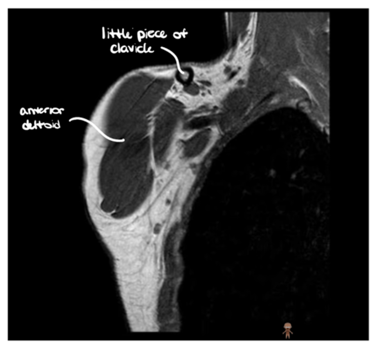 <p>1. Which view is this?</p><p>2. How do we know -- from what we can see here?</p>