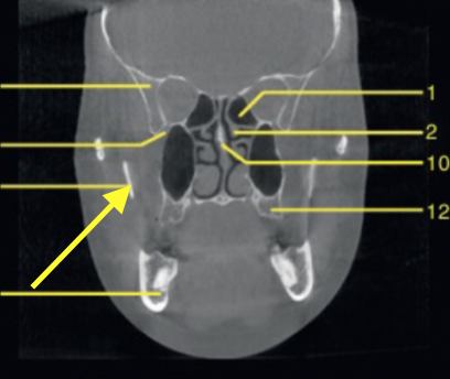 <p>identify structure </p>