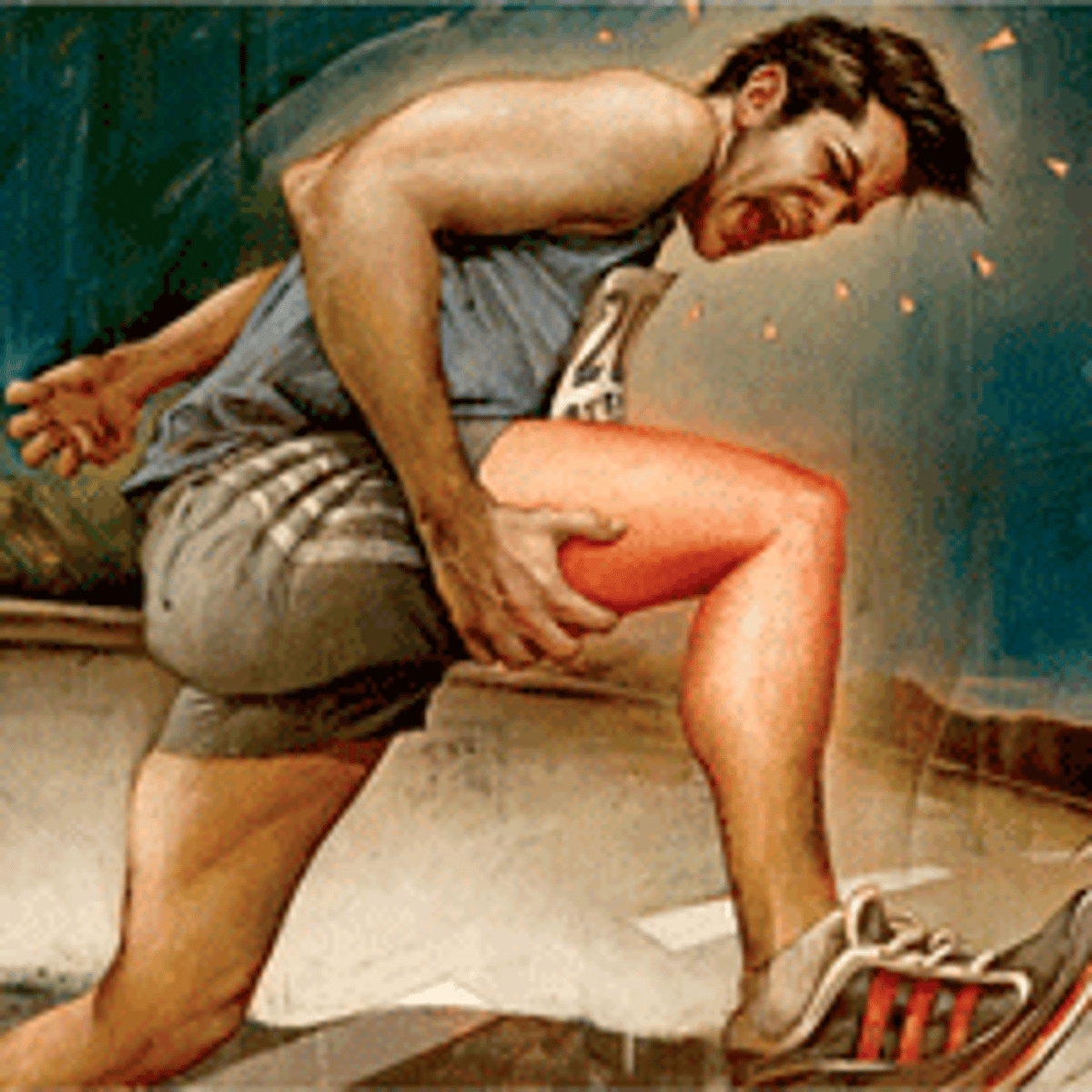 <p>muscle cramp</p>
