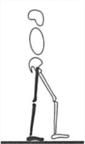 extending to 10º of flexion 
-thigh at 0º