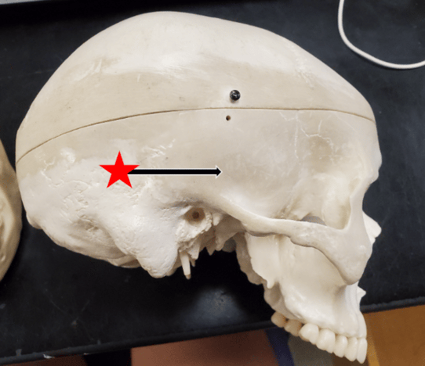 <p>Name the starred region in the image.</p>
