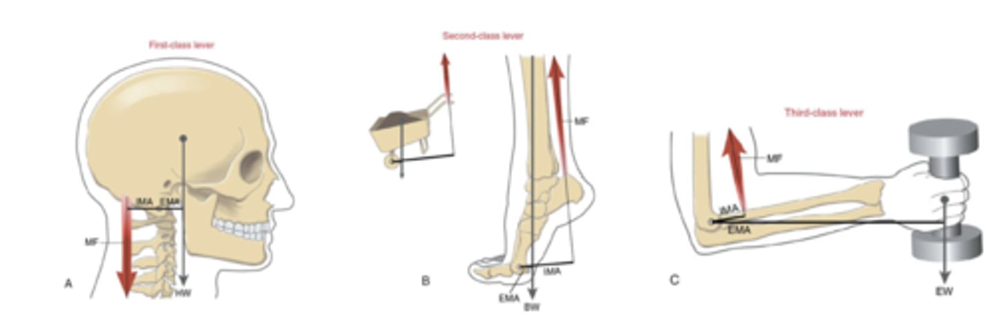 <p>Mechanical Advantage (MA) of a musculoskeletal lever is the ratio of its internal and external moment arms: IMA/EMA</p><p>MA=IMA/EMA</p><p>MA &gt; 1 higher force potential</p><p>MA &lt; 1 lower force potential</p>