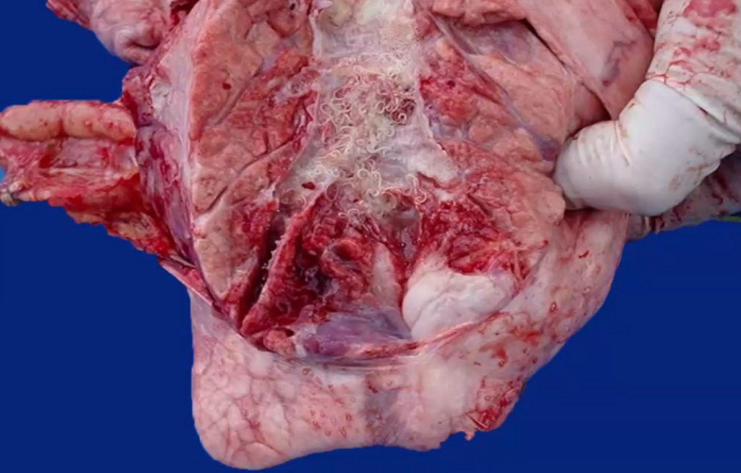 <p>What is the etiology?</p><p>A-Dictyocaulus viviparus</p><p>B-Dictyocau/us Ji/aria</p><p>C-Dictyocaulus arnolfi</p><p>C-Aelurostrongy/us abstrusus</p>