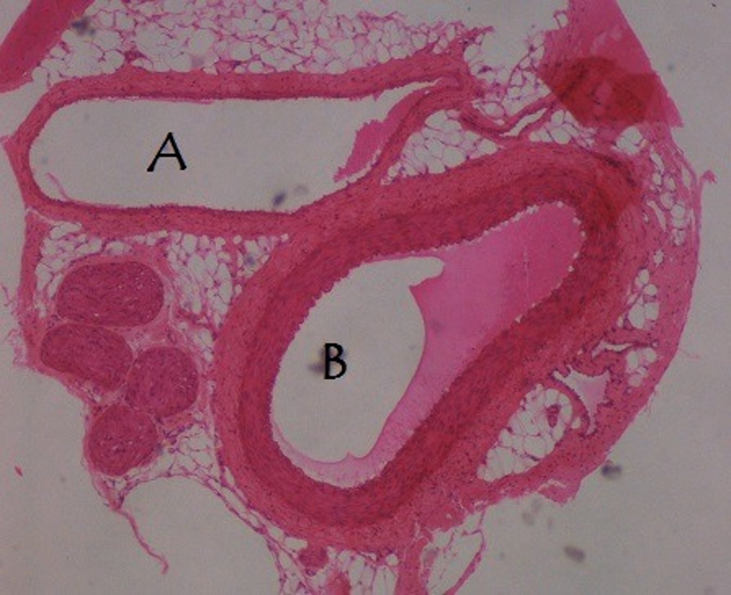 <p>The space within a blood vessel</p>