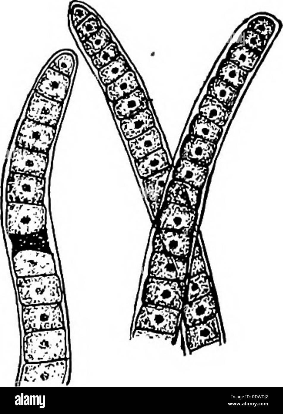 <p>what is this PROkaryotic cell? (<span style="font-family: Google Sans, Roboto, arial, sans-serif">Cyanobacteria)</span></p>