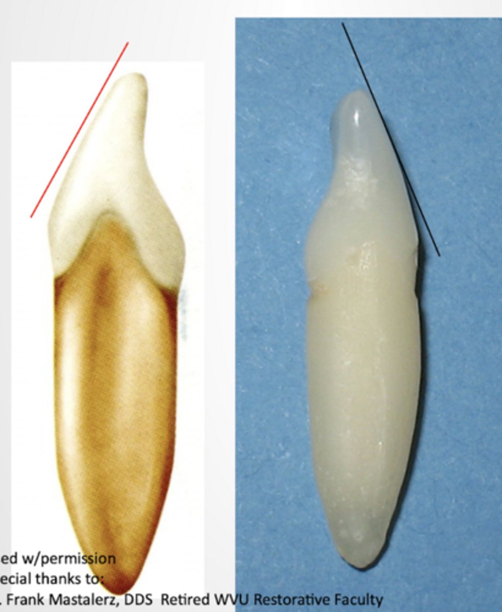 <p>- Facial margin straight line from height of contour to incisal</p><p>- Lingual edge convex (sticks out) at cingulum, concave (scoops in) up to incisal ridge, and convex (sticks out) at incisal ridge</p><p>- CEJ more curved</p>