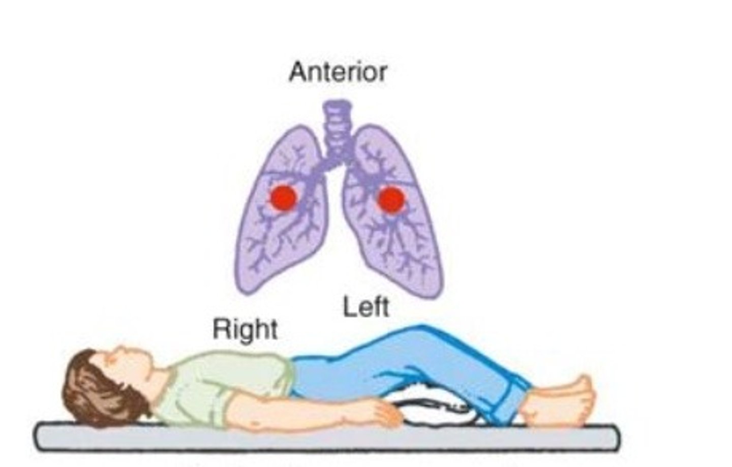<p>- Position the patient supine with the bed flat.</p><p>- Area to percuss is just above the nipple.</p>
