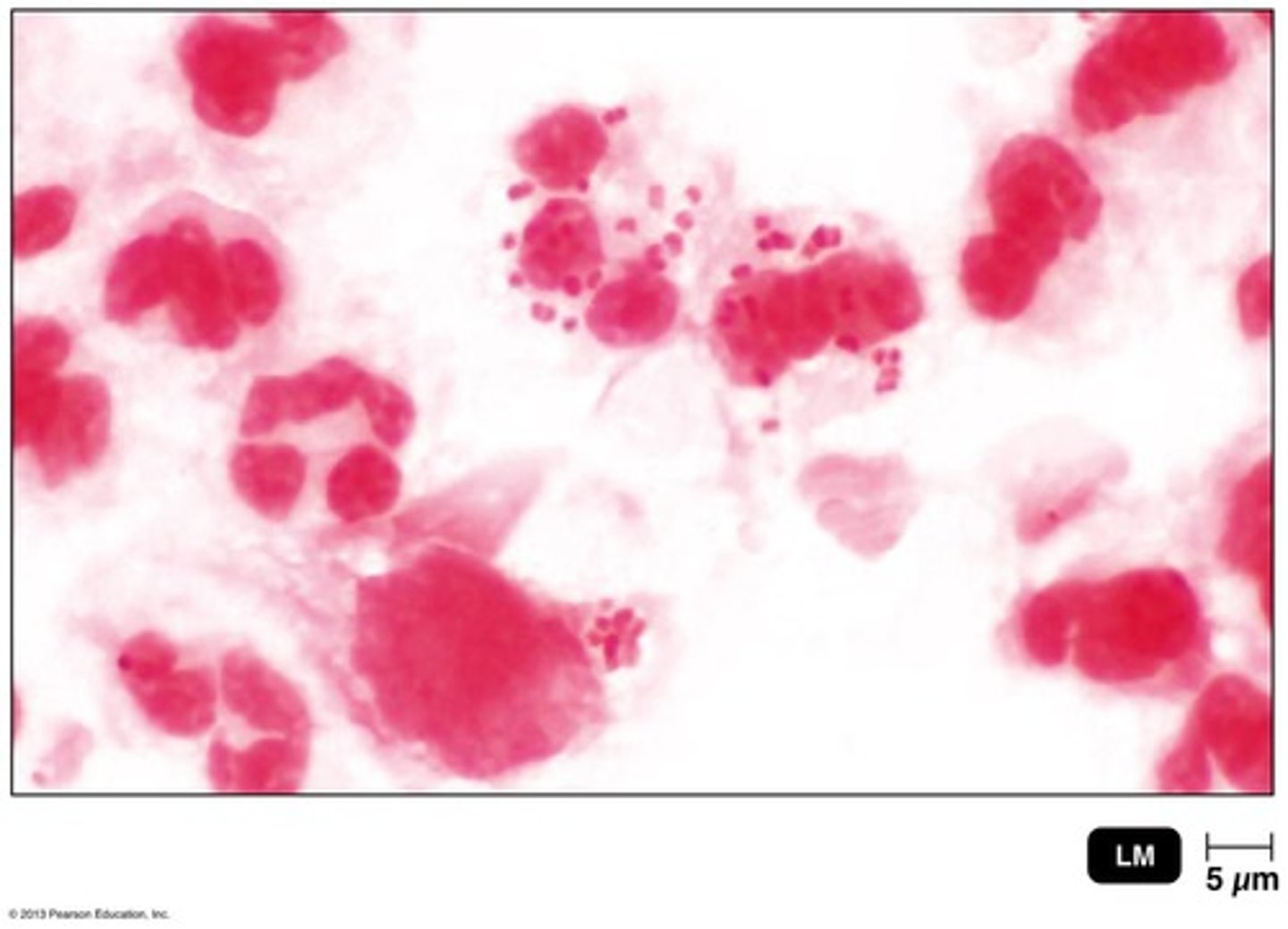 <p>Neisseria gonorrhoeae, a gram-negative diplococcus.</p>