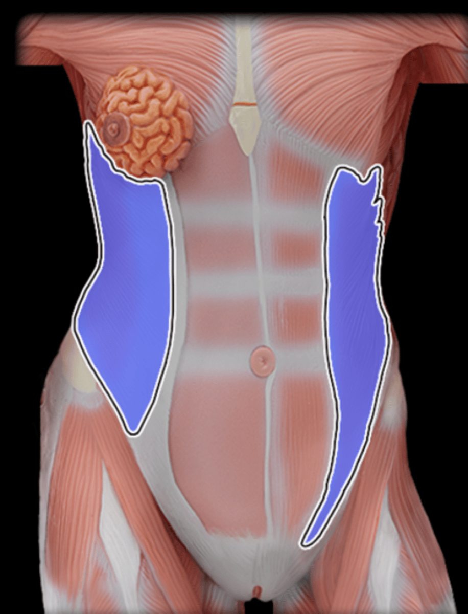 <p>What Muscle Is Highlighted?</p>