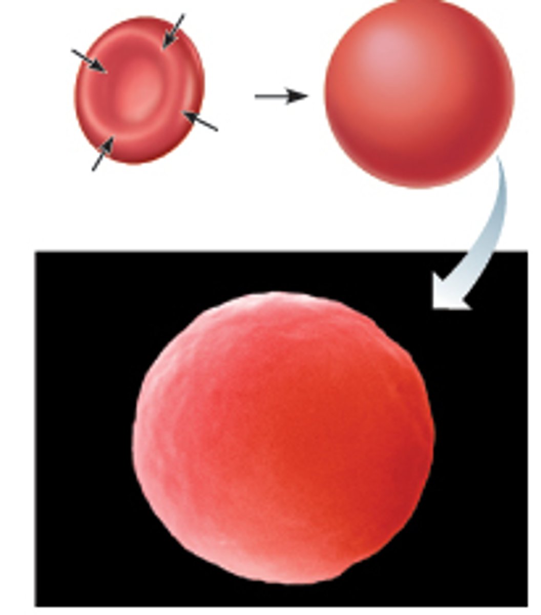<p>-gain water from surroundings</p><p>-concentration of solutes lower outside the cell</p><p>-cell will gain water-&gt; cells swell and lyse (burst)</p><p>-plant cells work OPTIMALLY (maintain turgor pressure)</p>