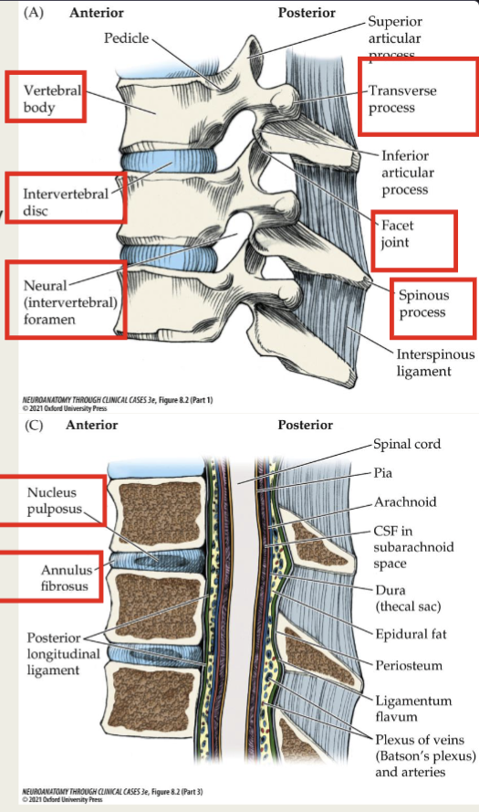 <p>connective tissue that separates vertebral bodies from each other </p><p>consisting of:</p><ul><li><p>Central nucleus pulposus surrounded by</p></li><li><p>A capsule called annulus fibrosus</p></li></ul><p></p>