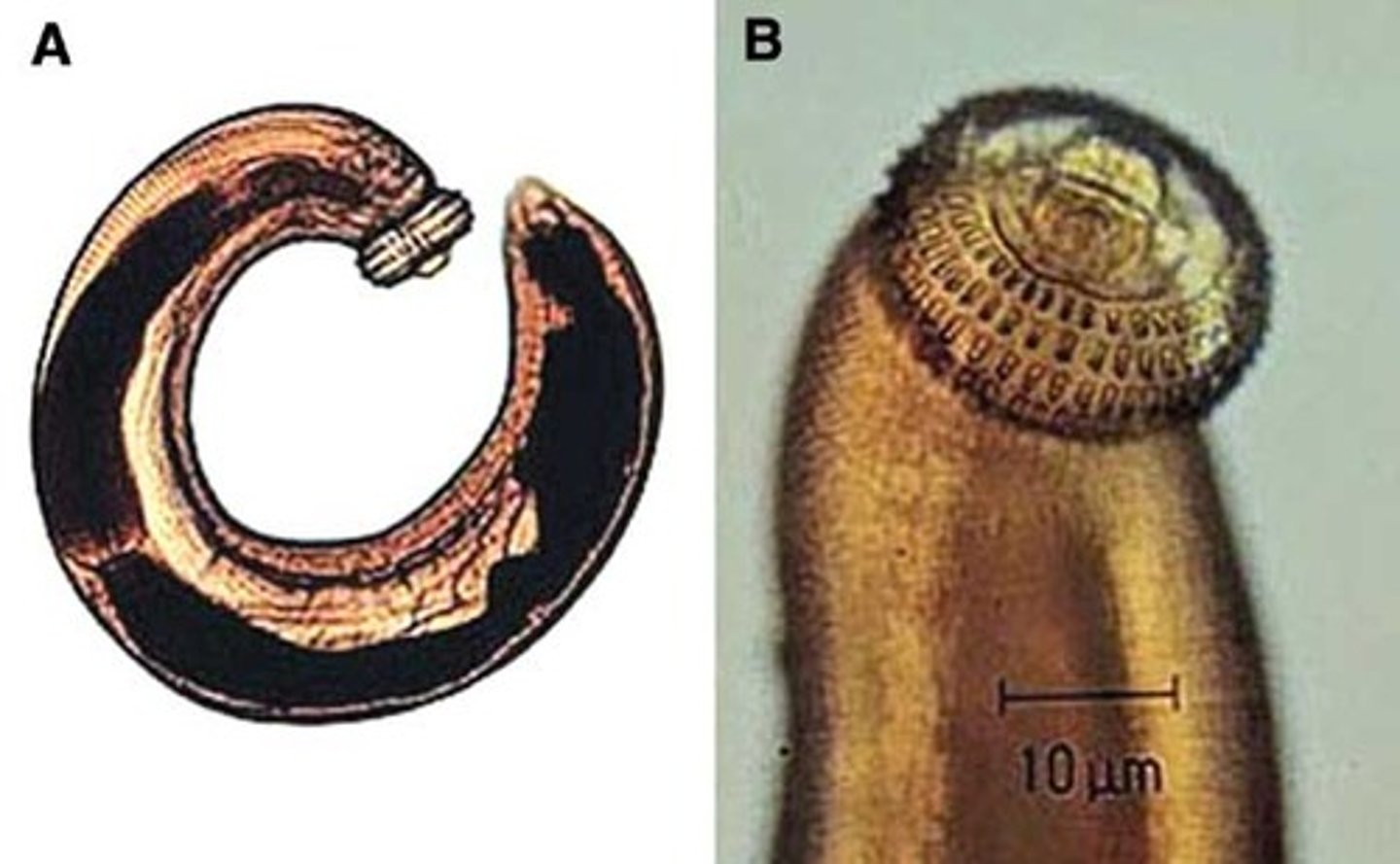 <p>stomach worm</p><p>vomit the worms!</p><p>zoonotic! don't eat undercooked fish</p><p>tx = albendazole</p>