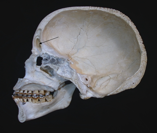 frontal sinus 