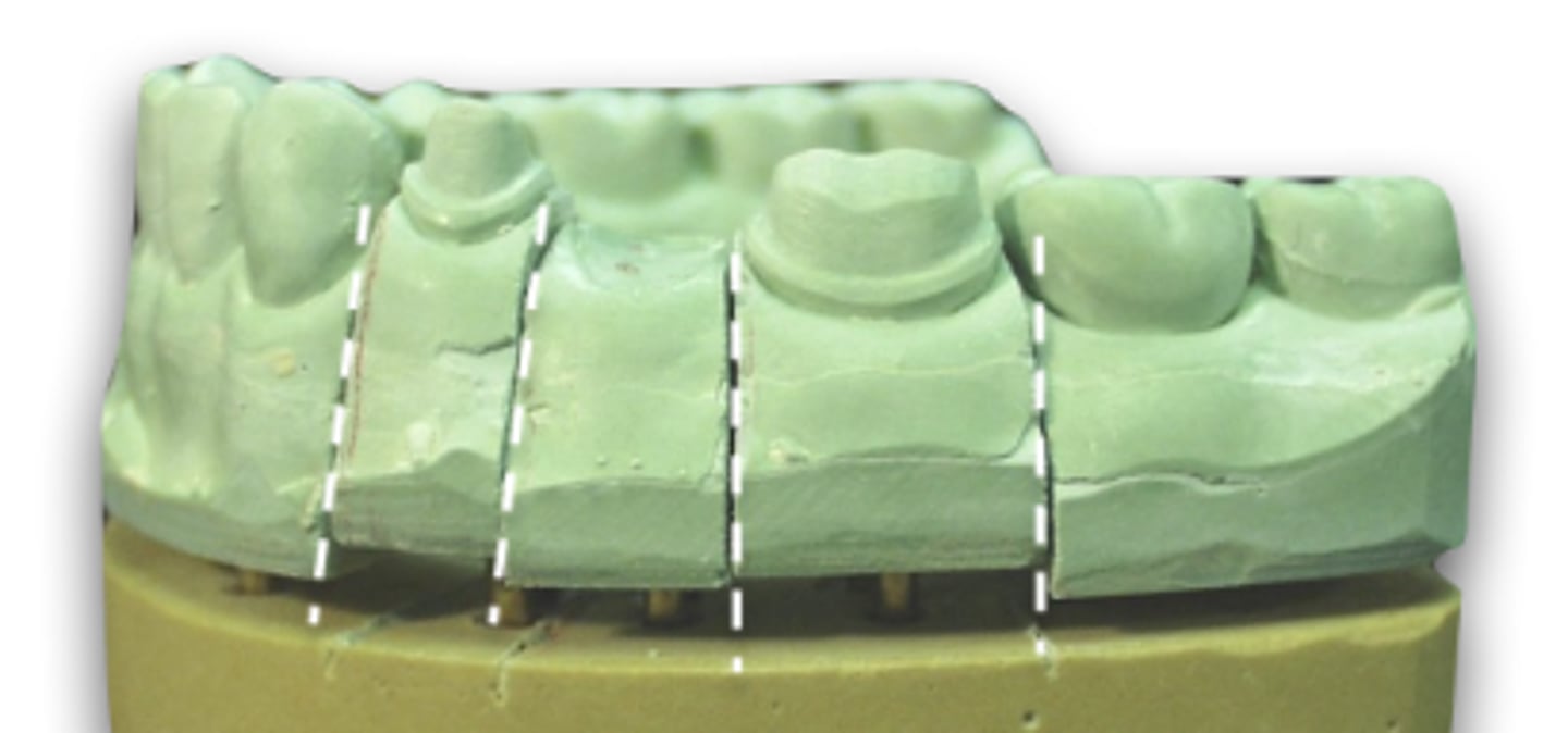 <p>When sectioning the die, it should be parallel or slightly __________ occlusally</p>