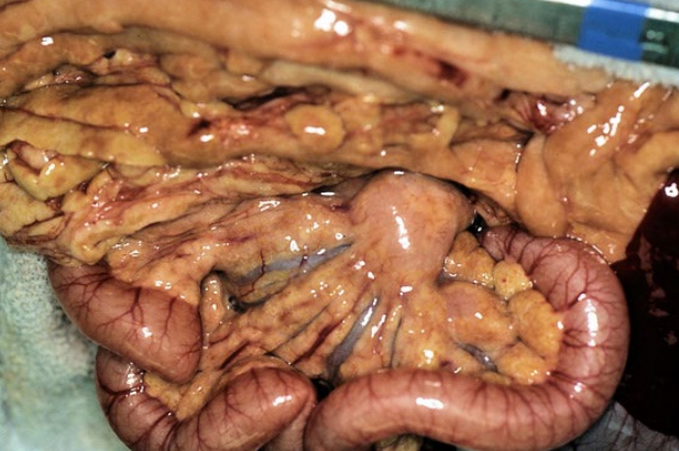 <p>Tissue from a 3-year-old, MC, DSH cat. Clinical history: The cat has been on an all-tuna diet for the past 6 months. Abdominal palpation revealed that the subcutaneous and visceral fat stores felt firmer and more nodular than expected. Morphologic diagnosis?&nbsp;Name of condition?</p>